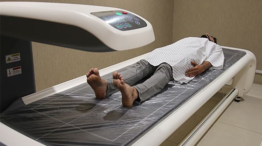 DEXA SCAN DEXA SCAN